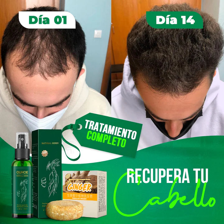 Elixir Ouhoe Capilar Para Crecimiento y Control de caída